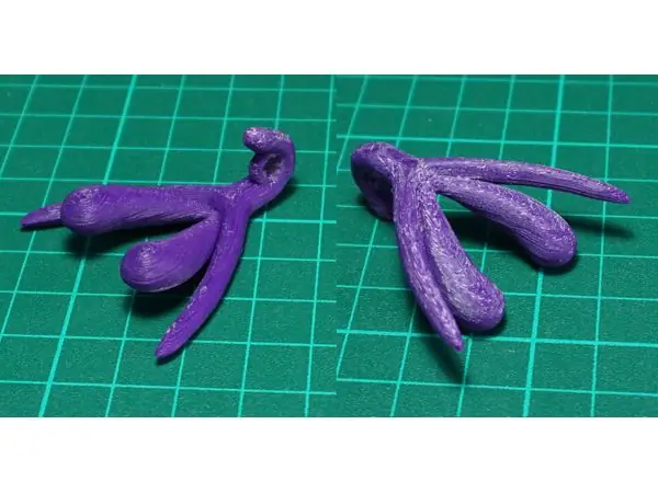 Clitoris