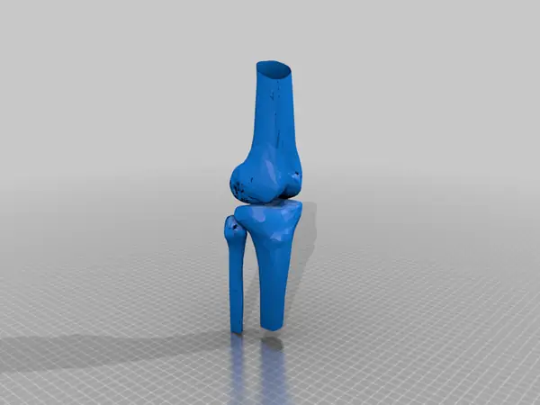 Knee joint