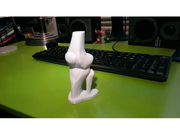 Knee joint