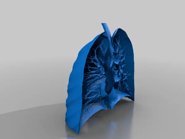 Cross section of a lung