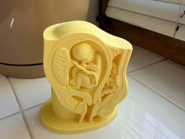Pregnancy Anatomy Cross-Section – Fetus in Utero