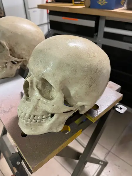 HUMAN SKULL - MEDICAL SCAN | CRÂNE HUMAIN