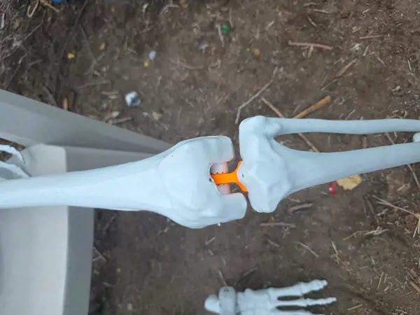 6 foot skeleton knee joint repair